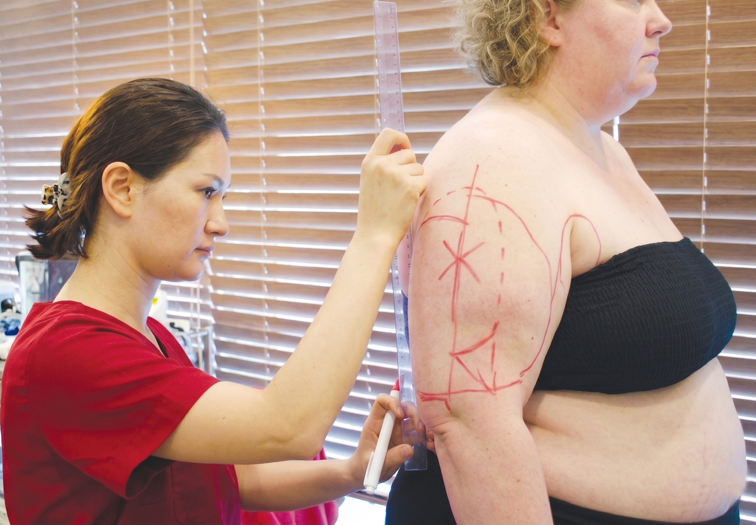Body Contouring in Korea