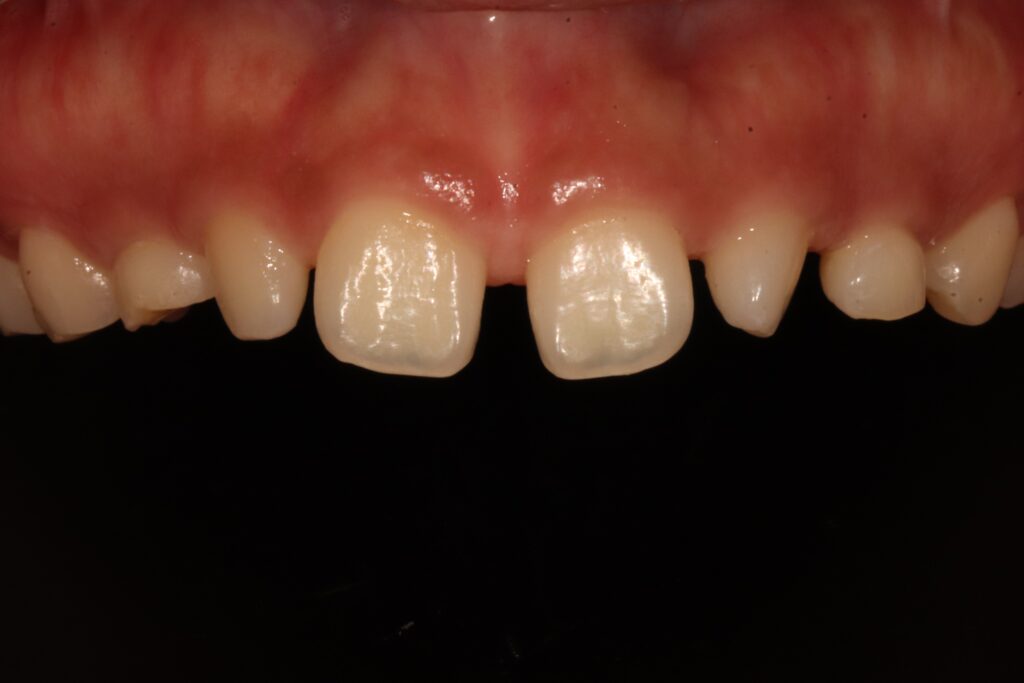 Dental Treatment in Busan