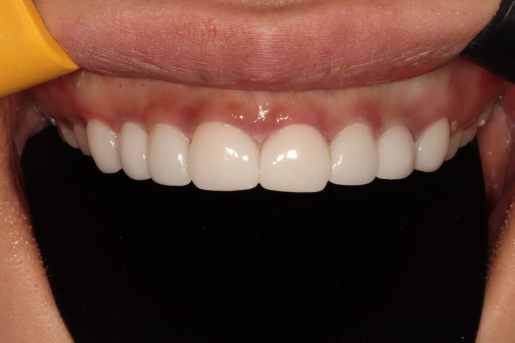 Dental Treatment in Busan
