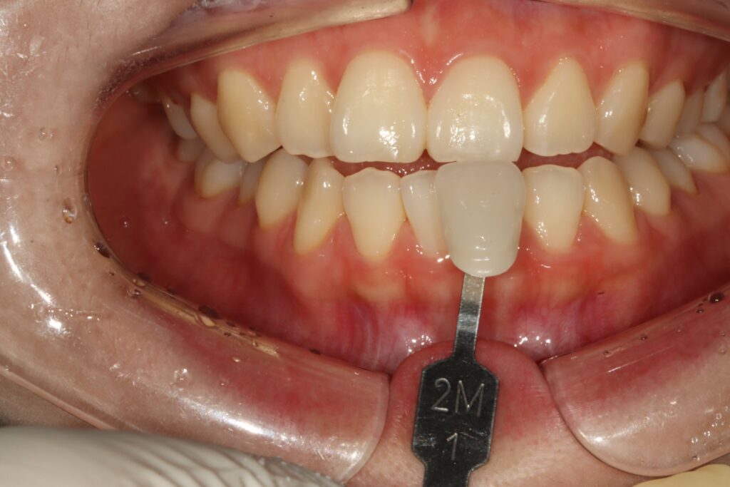 Dental Treatment in Busan