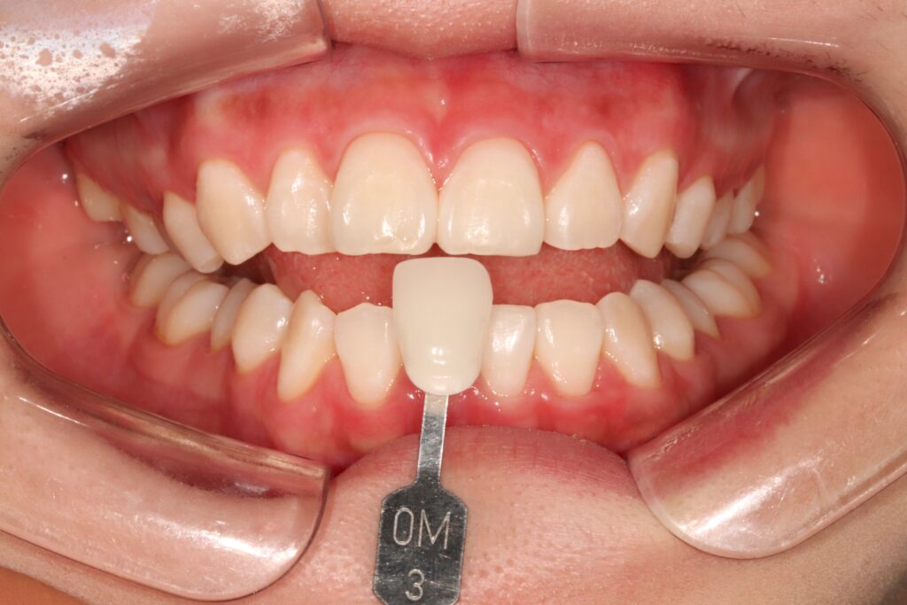 Dental Treatment in Busan