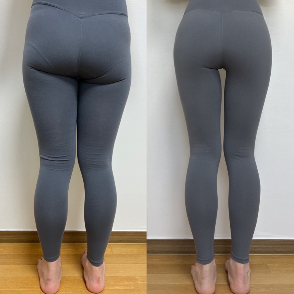 Body Contouring in Korea